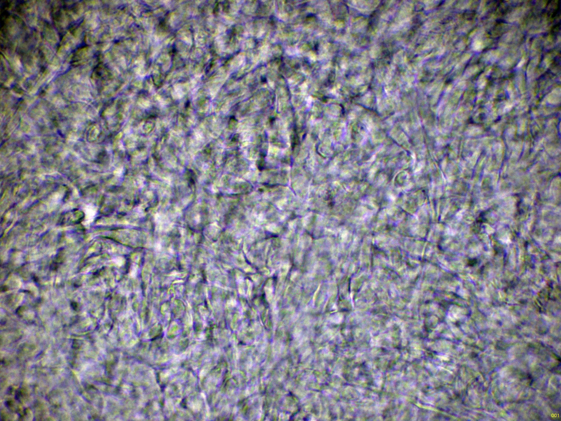 Microscopía de Helvella levis - 10 - Excípulo medular Melzer-001